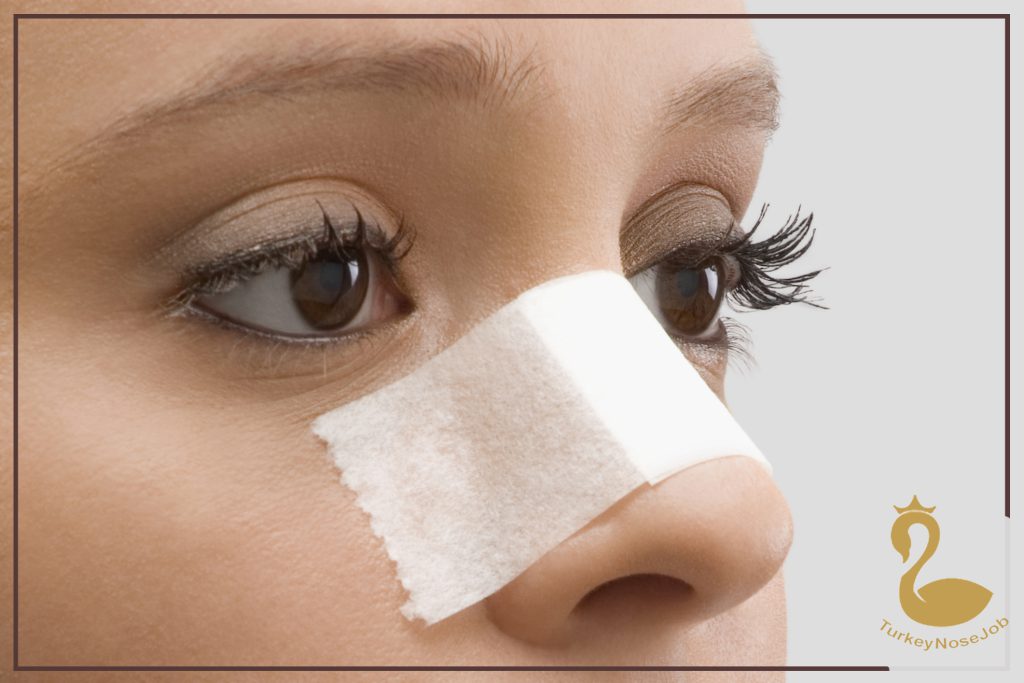 ALL YOU NEED TO KNOW ABOUT NASAL PACKING AFTER RHINOPLASTY